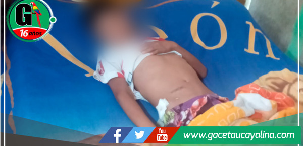 Alegaciones de negligencia médica en hospital de La Banda y Tarapoto