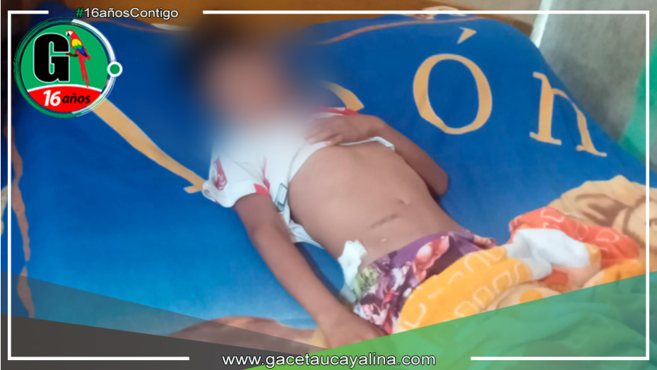 Alegaciones de negligencia médica en hospital de La Banda y Tarapoto