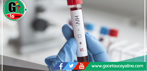 Reportan 118 casos de VIH SIDA en la provincia de Bagua 