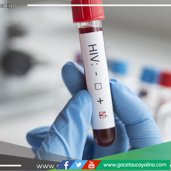 Reportan 118 casos de VIH SIDA en la provincia de Bagua 