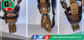 Goreu y DIRESA logran donación de 25 prótesis de manos para personas con discapacidad