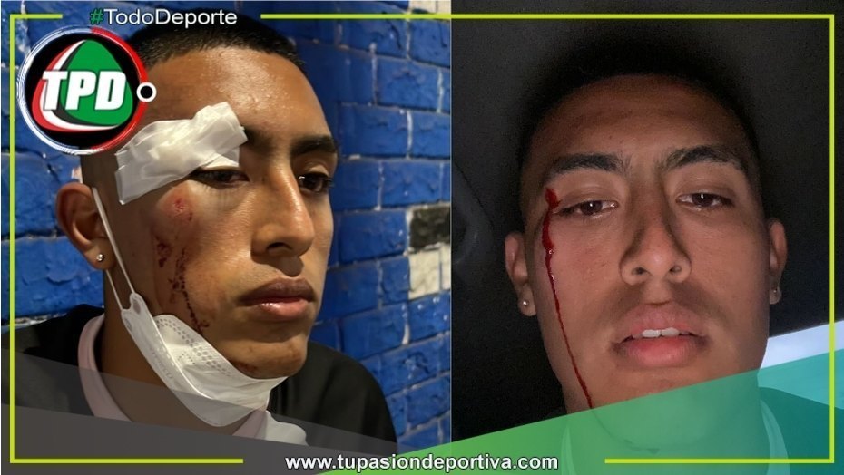 Fabrizio Roca, jugador de Sport Boys, fue agredido cerca de su casa