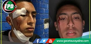 Fabrizio Roca, jugador de Sport Boys, fue agredido cerca de su casa