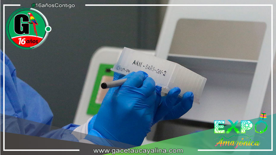 Cusco reporta un caso de Fornax, nuevo linaje de enfermedad