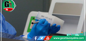 Cusco reporta un caso de Fornax, nuevo linaje de enfermedad 