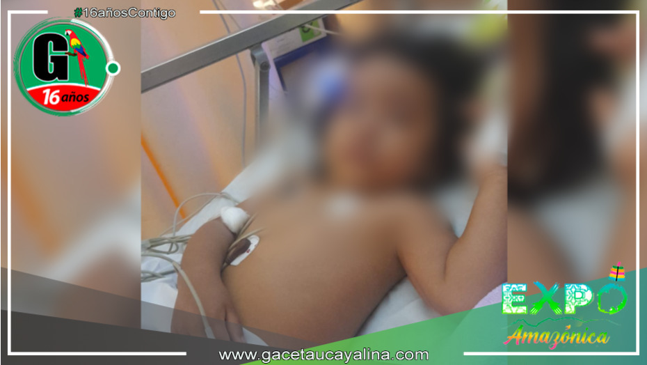 Niña resulta herida por agua caliente en accidente doméstico