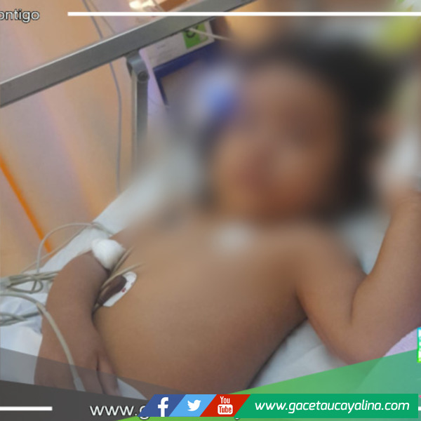 Niña resulta herida por agua caliente en accidente doméstico