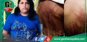 Madre Arrestada por Agredir Brutalmente a su Hija Menor en San Alejandro