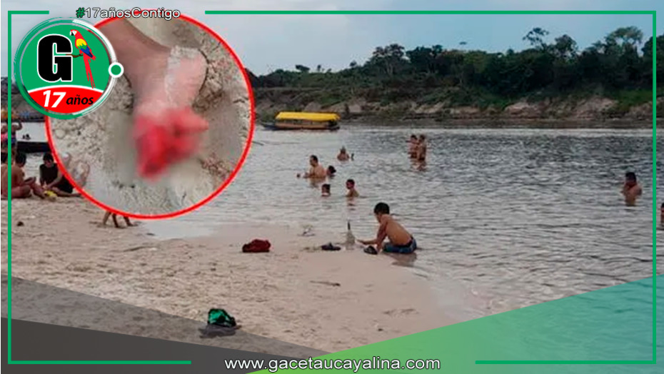 Ataque de pirañas en Iquitos deja 10 heridos