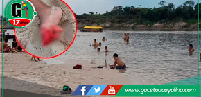 Ataque de pirañas en Iquitos deja 10 heridos