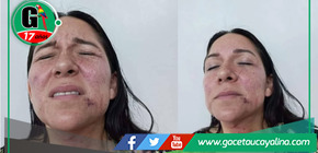 Paola Bances, regidora municipal en estado grave por presunta agresión de su esposo