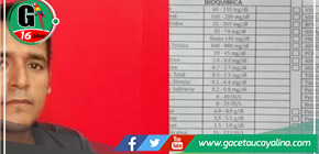 Paciente con Leishmaniasis en Moyobamba clama por tratamiento urgente