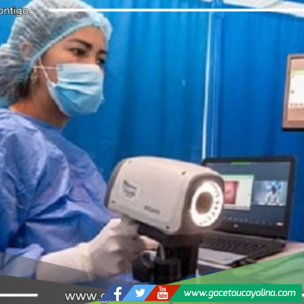 Inician campaña de prevención de cáncer de cuello uterino en Loreto, Huánuco 