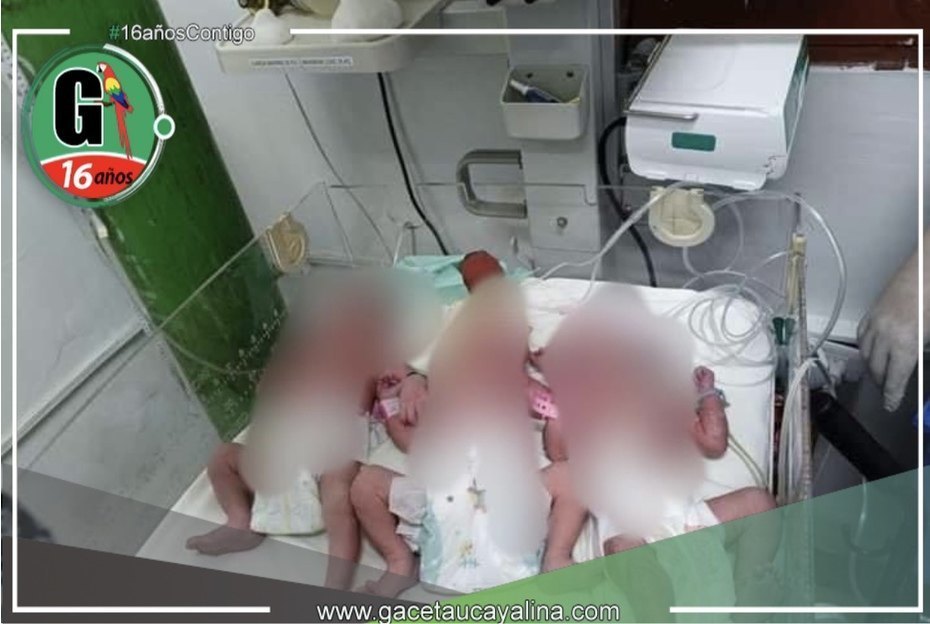 Nacen trillizos en Hospital Iquitos: Un logro médico y humano
