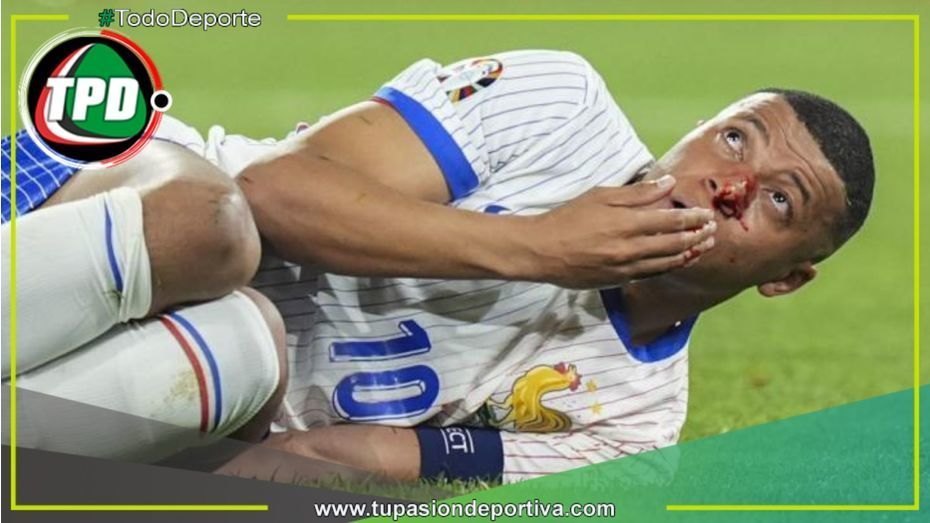 Mbappé debutó en la Eurocopa y terminó con la nariz rota
