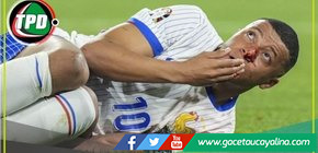 Mbappé debutó en la Eurocopa y terminó con la nariz rota