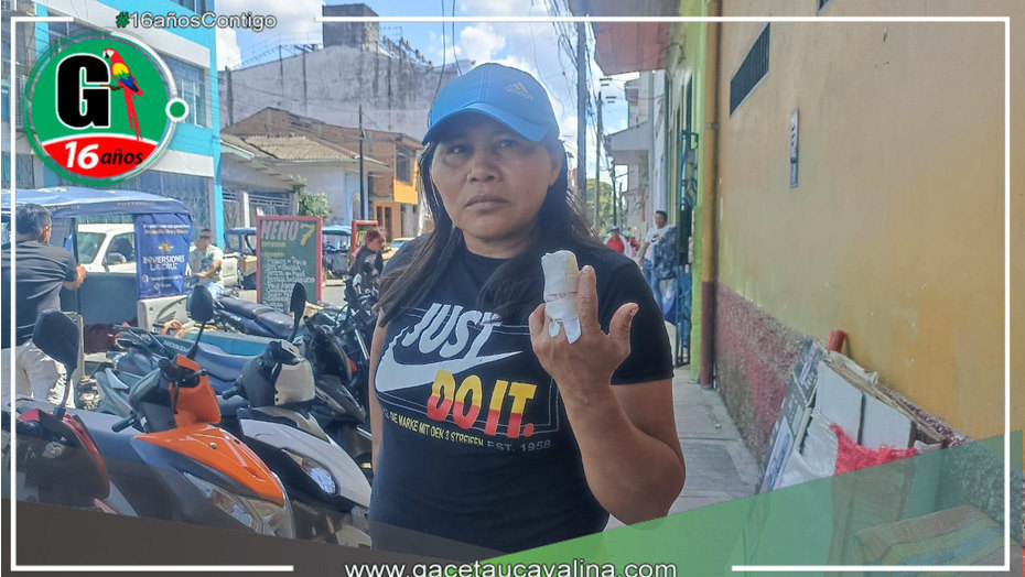 Mujer se fractura el dedo