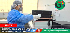 Hospital Regional de Loreto incorpora inmunohistoquímica y moderniza la detección de cáncer en la Amazonía.