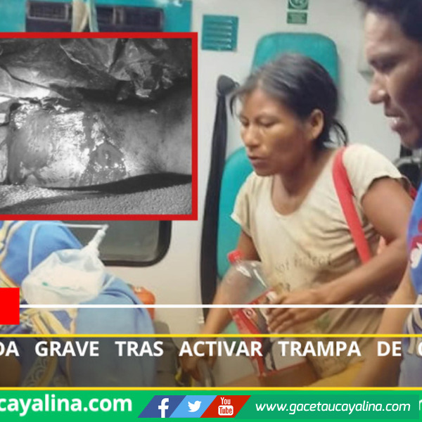 Hombre queda grave tras activar trampa de caza en Atalaya