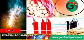 Explosión de pirotecnia deja niño con severo daño ocular.