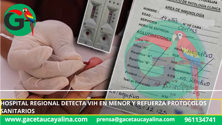Alerta sanitaria en Pucallpa tras diagnóstico de VIH en adolescente